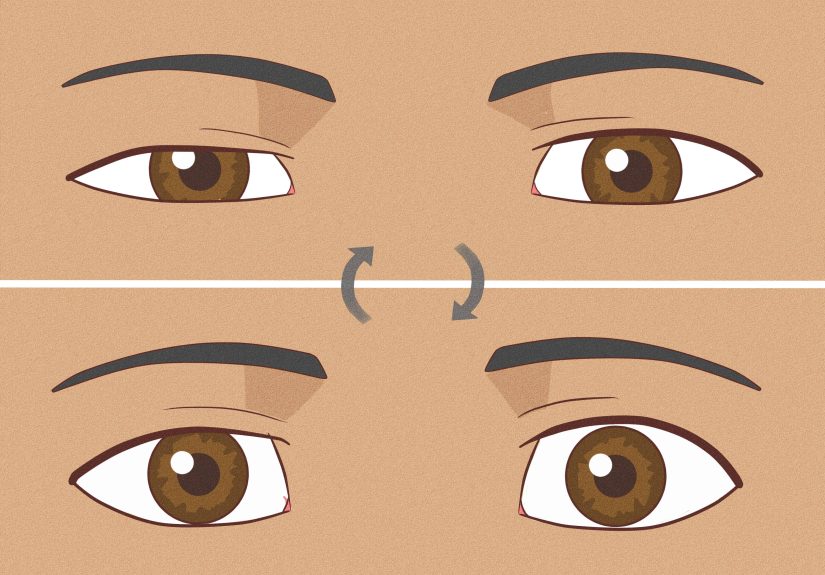 12 Ways to Fix Asymmetrical Eyes