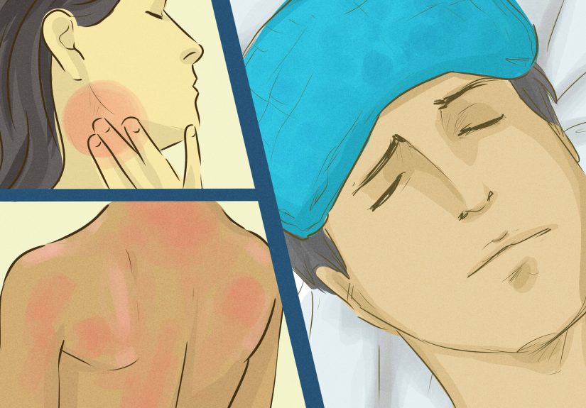 3 Ways to Treat a Chemical Burn