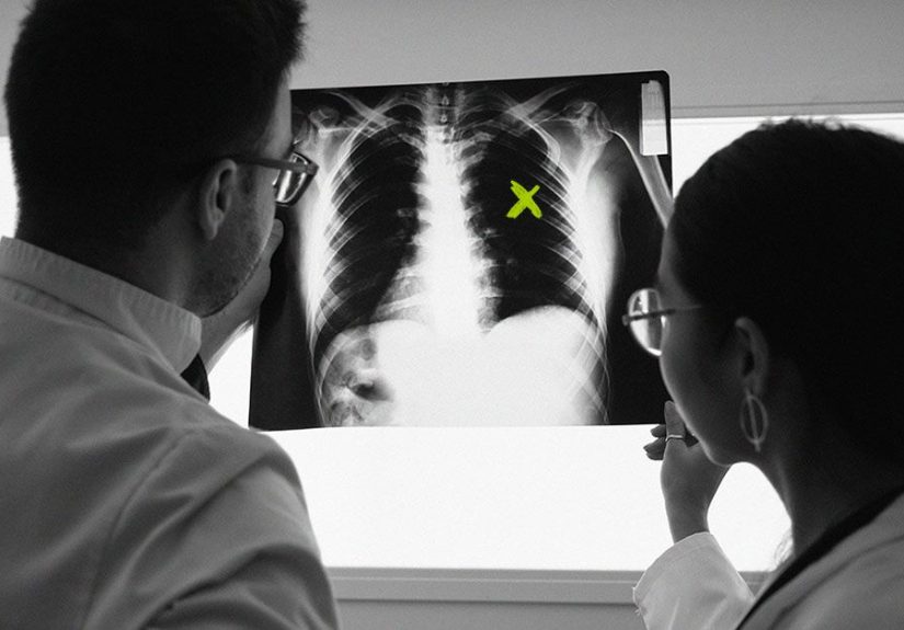 6 possible causes of rib cage pain