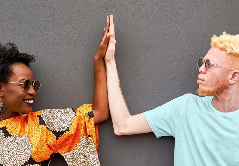 Albinism: Causes, Types, Pictures, Symptoms, and More