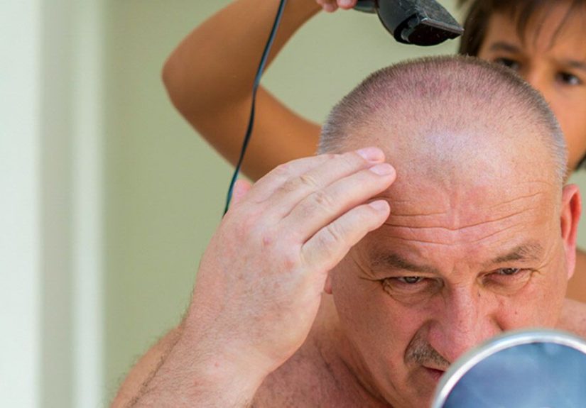Cradle Cap in Adults: Treatment, Causes, Product Recommendations