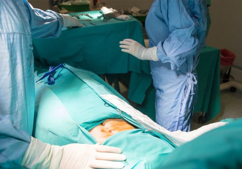 Extended Tummy Tuck: Procedure, Pictures, Cost, and More