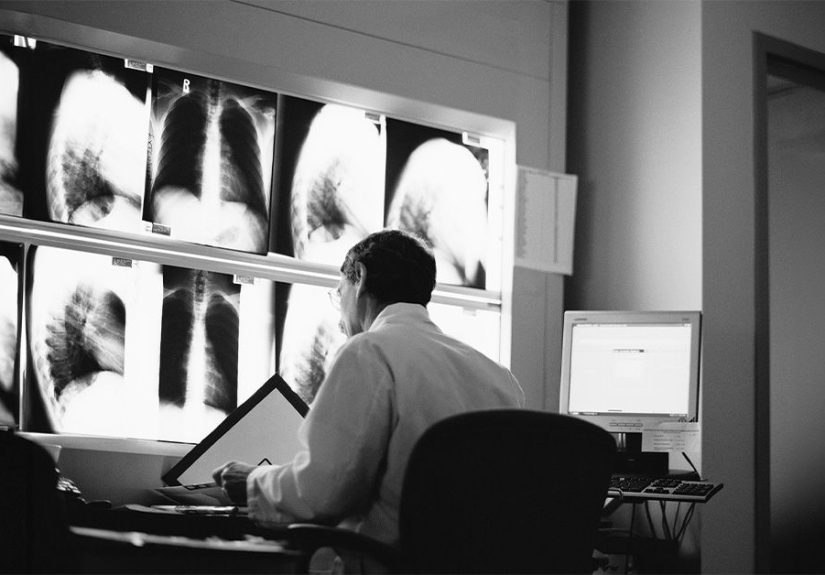 How do X-rays help diagnose bronchitis?