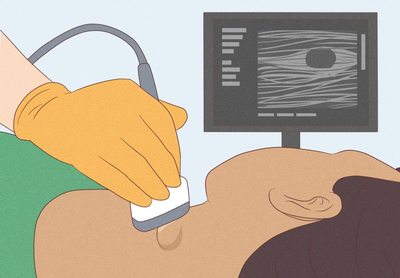 How to Check Your Lymph Nodes for Signs of Swelling