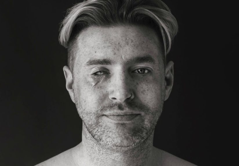 Scar Portraits