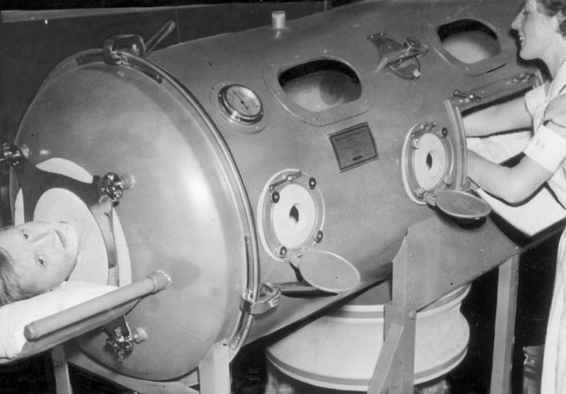 What Life Was Like In An Iron Lung