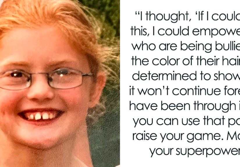 Woman Who Was “Spat At” And “Burned” At School For Having Ginger Hair Grows Up To Be Crowned Miss England