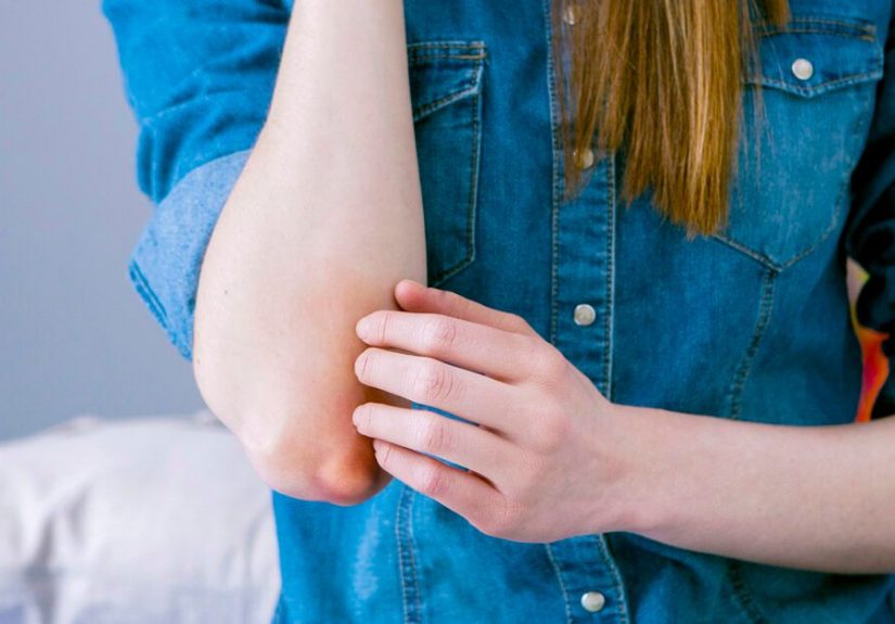 18 Causes of Bump on Elbow: Injury, Cyst, Bursitis, and More