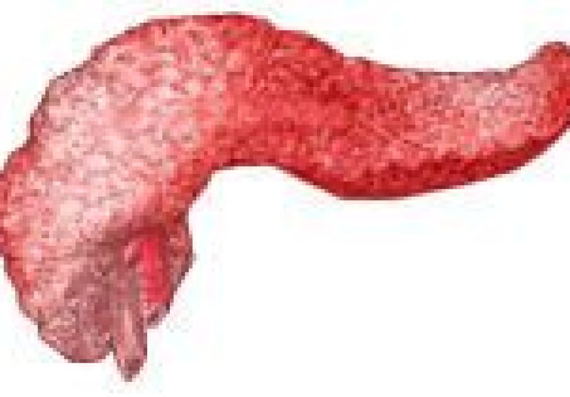 Acute Pancreatitis: Causes, Symptoms, and Treatments