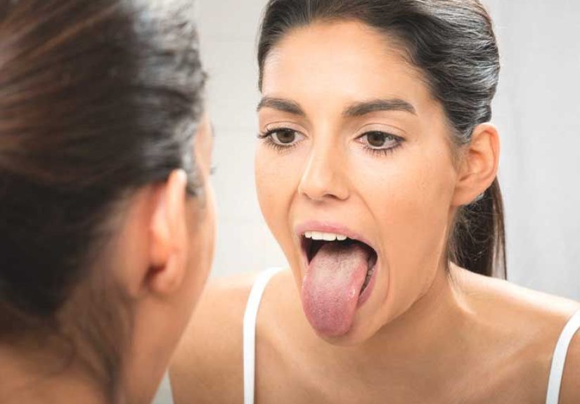 Bleeding Tongue: Treatment, Causes, and More