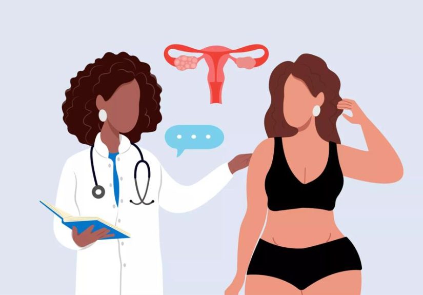 Can PCOS Cause Weight Gain?