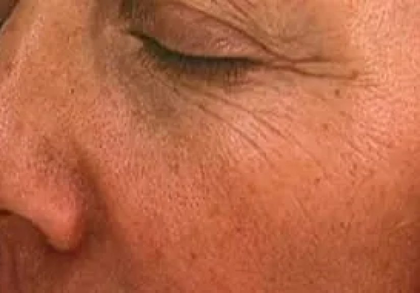 Hydrating Moisturizers: Ingredients, Product Options, and More - Watch WebMD Video