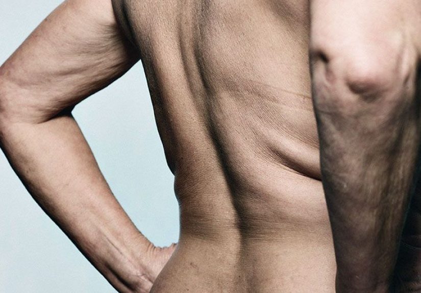 Middle back pain: Causes, treatment, and exercises