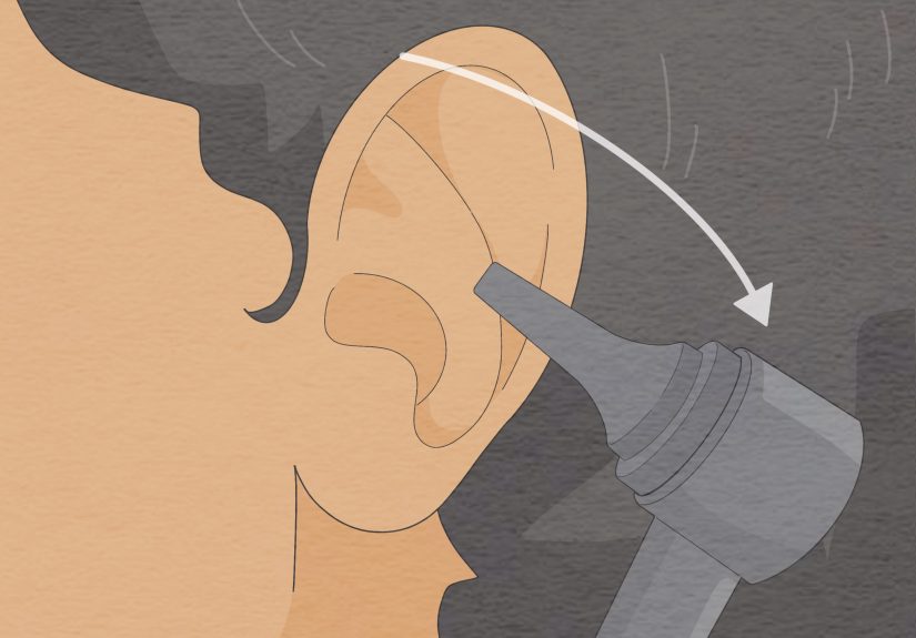Simple Ways to Look Into Your Own Ear: 12 Steps