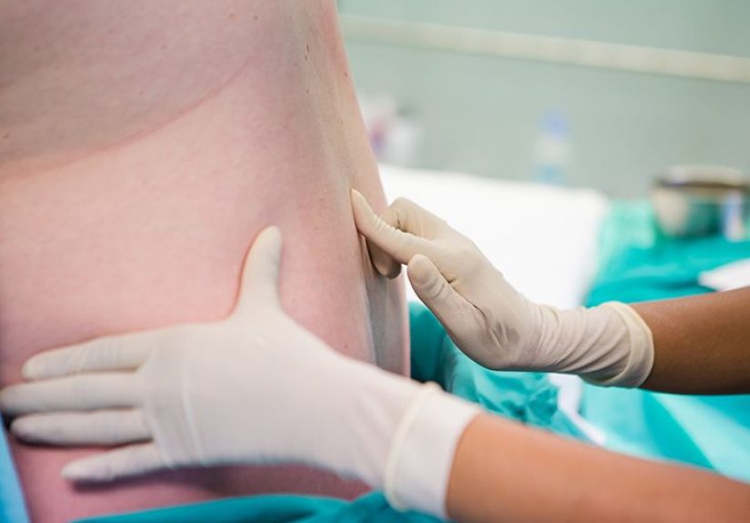 Thoracentesis: Definition, procedure, and risks