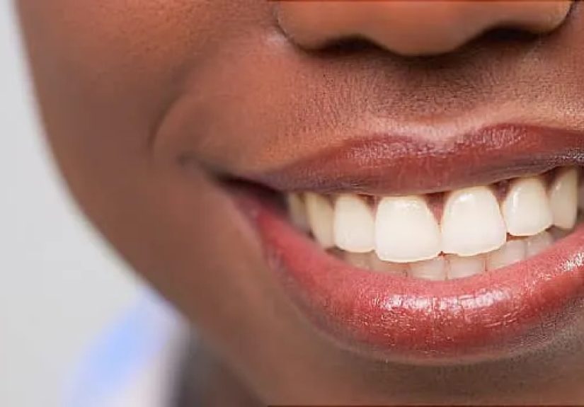 Tips to Make and Keep Lips Soft and Moisturized