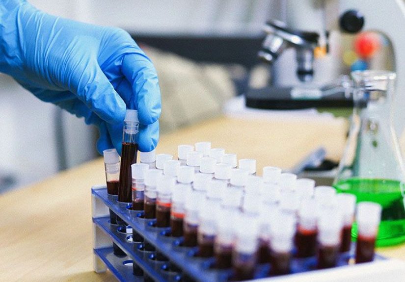 What to know about hepatitis B surface antibodies