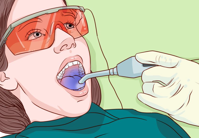 3 Ways to Whiten Teeth with Natural Methods