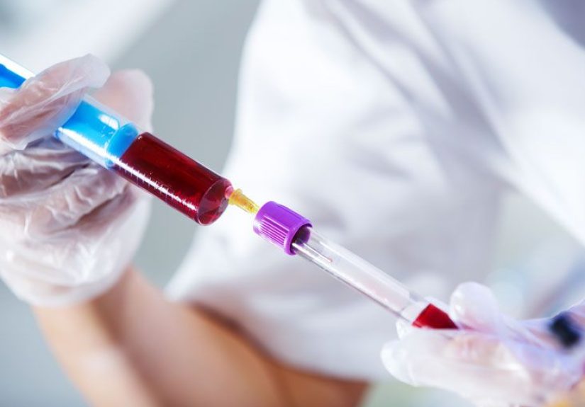 ACTH Hormone Stimulation Test: Purpose, Procedure, and Results