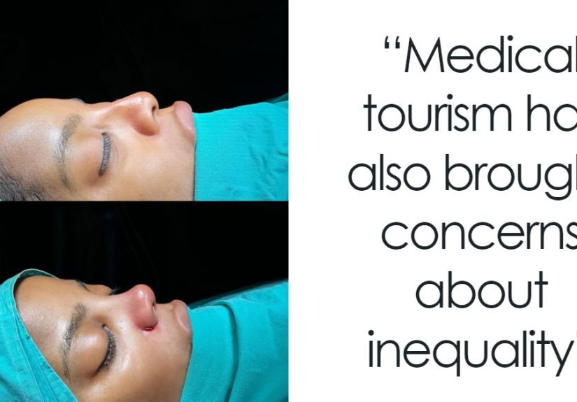 Activists Share Before And After Photos Of Their “Cheaper” Plastic Surgeries In Turkey