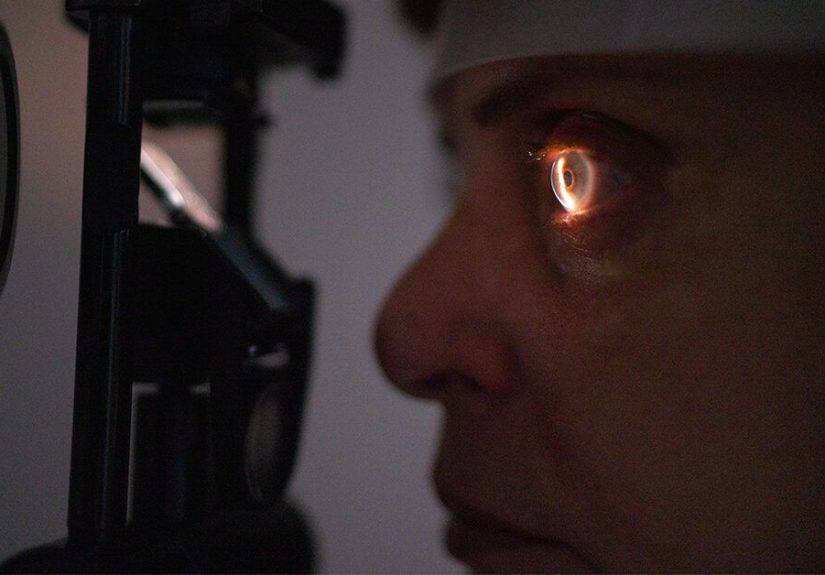 Can Cataracts Come Back After Cataract Surgery?
