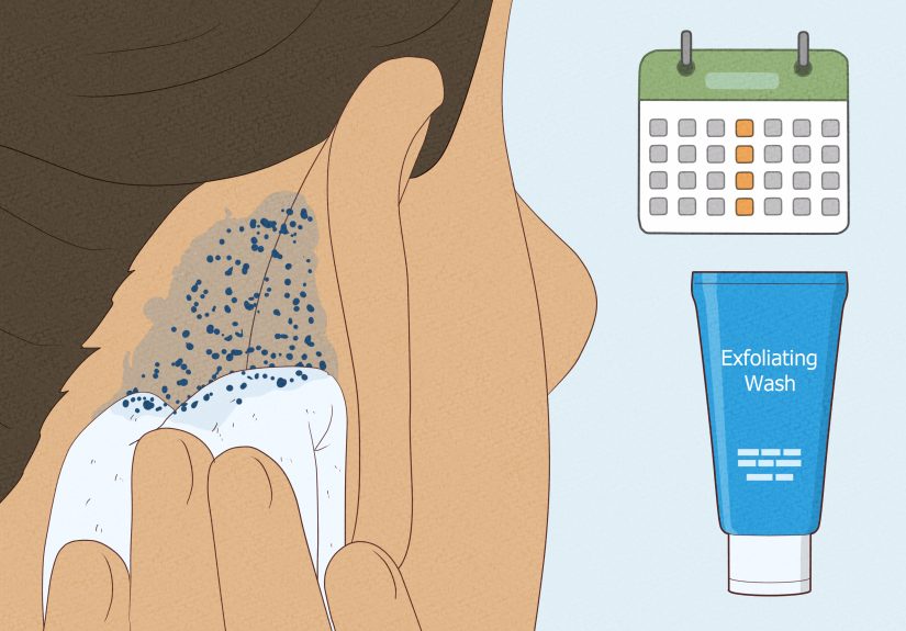 How to Get Rid of the Cheese Smell Behind Your Ears