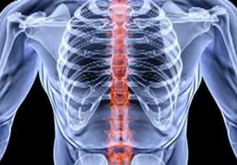 Inside a Bone Density Test - Watch WebMD Video