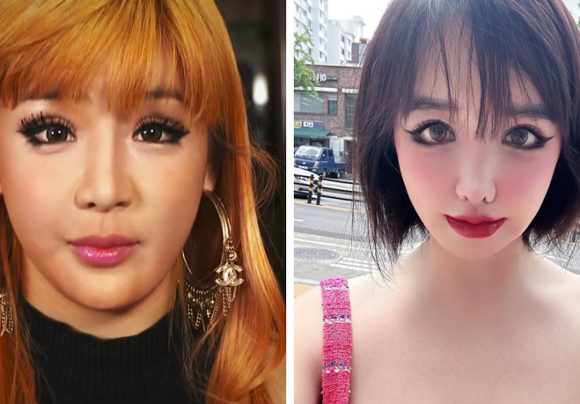 K-Pop Icon Park Bom Reveals Heartbreaking Reason Behind Drastic Plastic Surgery Transformation