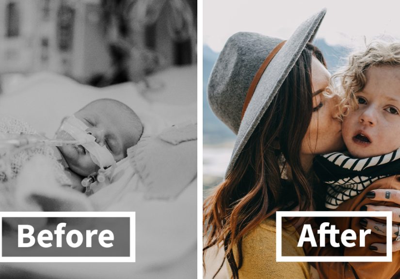 My Son Had Three Open Heart Surgeries Before The Age Of 5, And Here’s How Our Journey Went