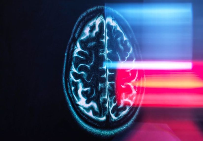 Unruptured brain aneurysm and behavior: What to know