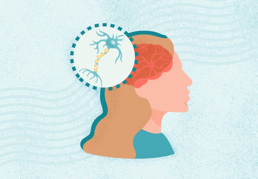 What Is Multiple Sclerosis (MS)? Symptoms, Causes, Diagnosis, Treatment, and Prevention