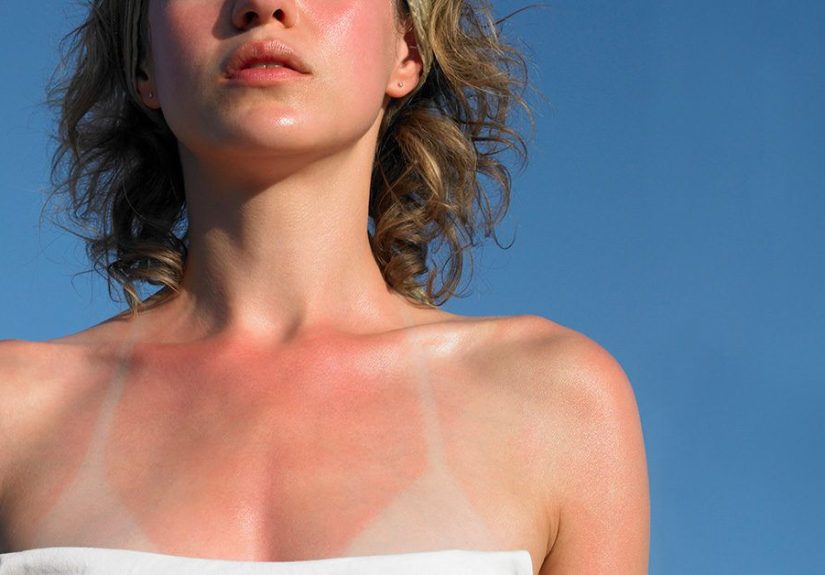 7 Body Parts Commonly Missed with Sunscreen