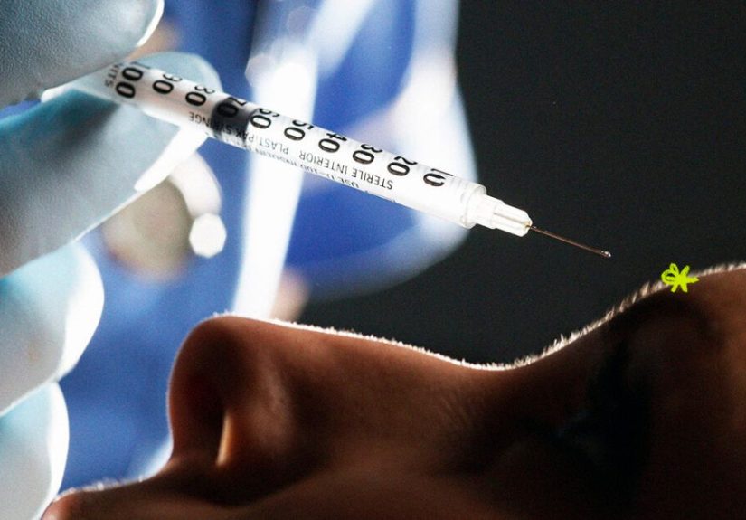 Botox for Trigeminal Neuralgia: Off-Label Use, Side Effects, and More