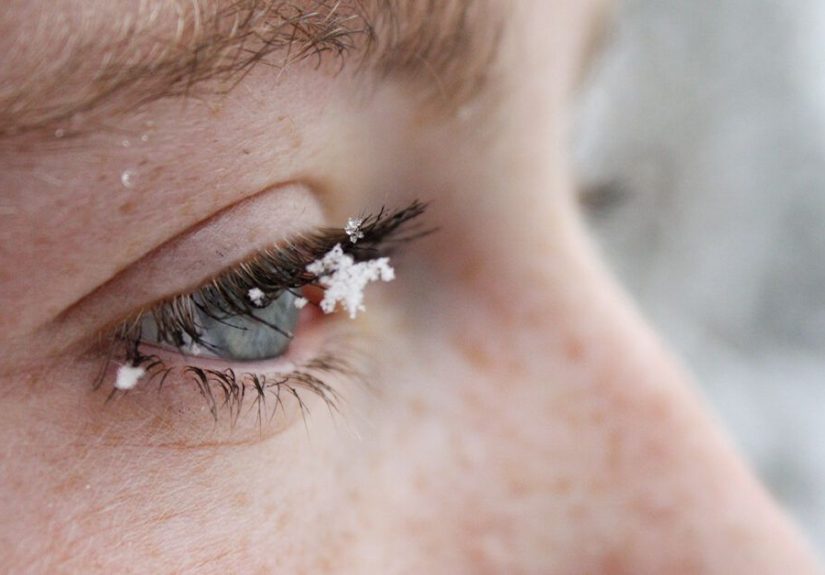 Dry Eyes in Winter: Causes, Treatment, and Prevention