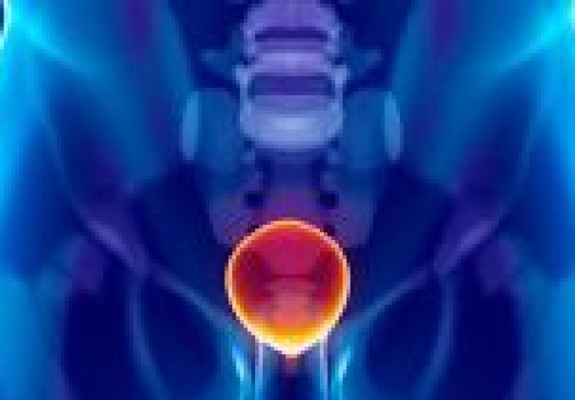 Male Chlamydial Urethritis: Causes, Symptoms, and Diagnosis