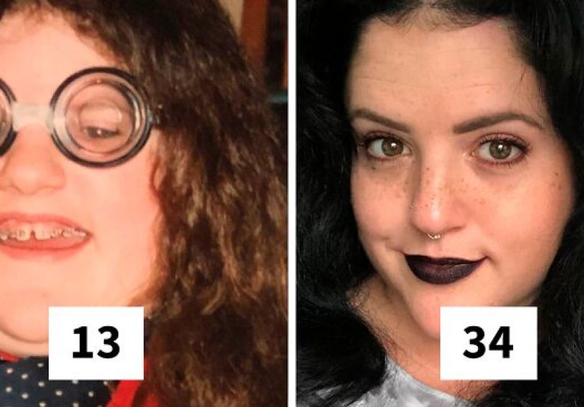 People Who Used To Be “Ugly Ducklings” Share Their Transformations, And We Can Barely Recognize Them