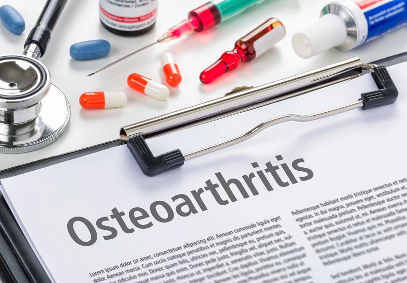 What Medicines Treat Osteoarthritis?