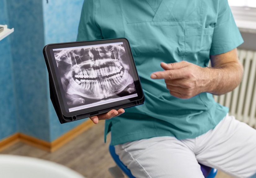 X-Ray: Purpose, Procedure, and Possible Risks